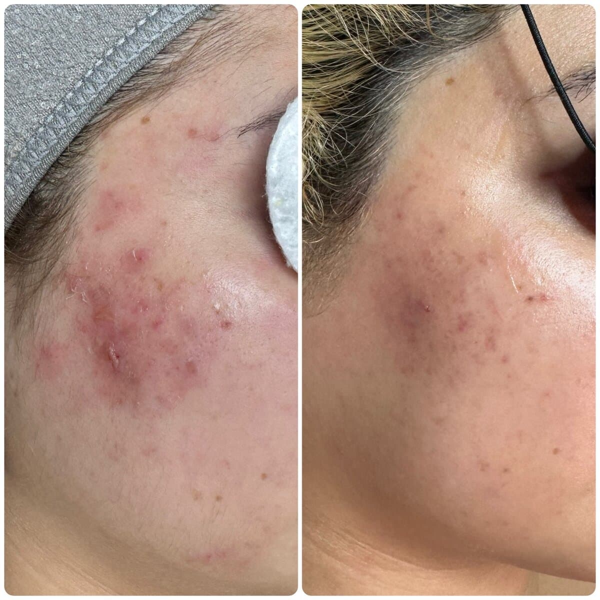 Advanced & Clinical at Beauty Balance by Jo